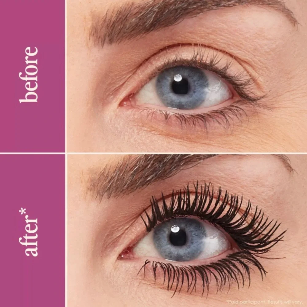 N/A black thickening